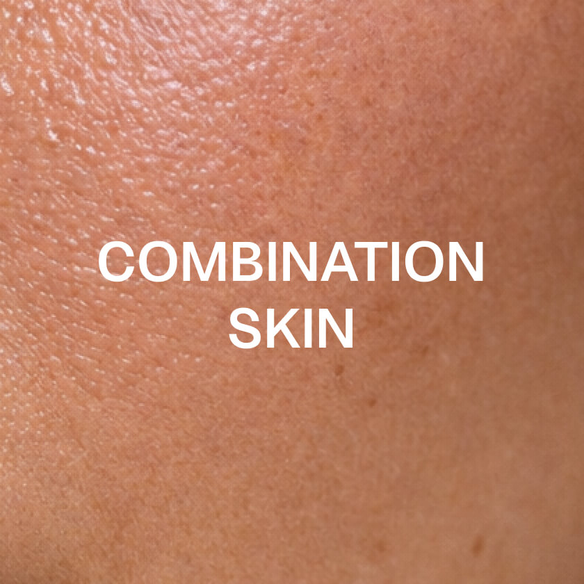 Gecombineerde huid