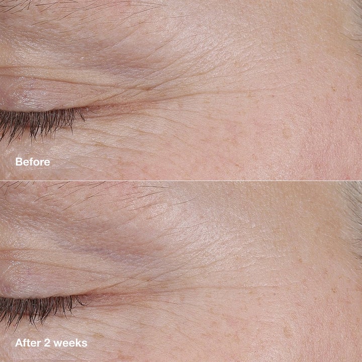 Retinol Intro - Mild Retinol-introduktion för Män som Vill Prova A-vitamin