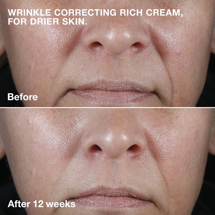 3-Step Skincare System