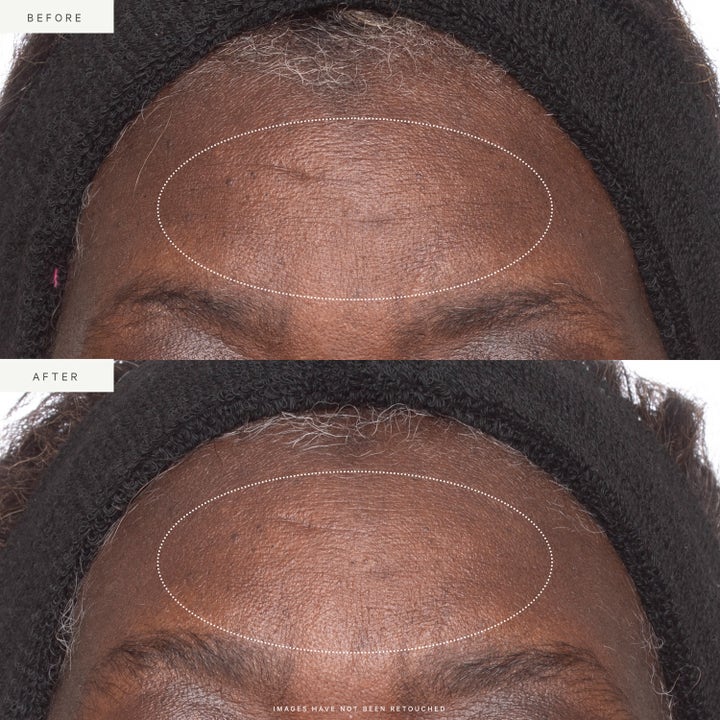 Plant Stem Cell Retinol Alternative Moisturizer