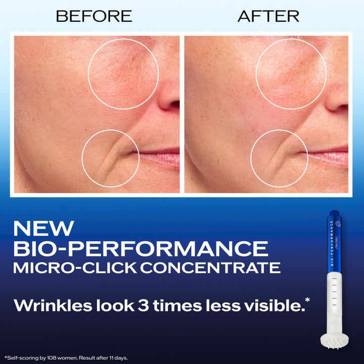 Bio Performance 2.0 Micro Needle