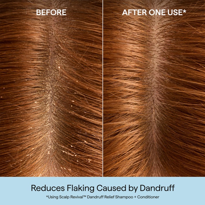 Scalp Revival™ Dandruff Relief Conditioner