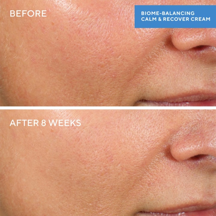 Biome-Balancing Calm + Recover Cream