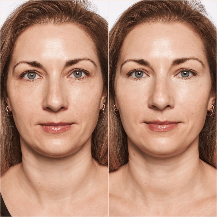 Eye Perfecting Set