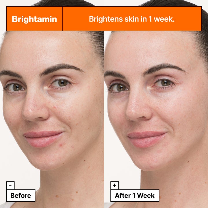 Brightamin Brightening Serum Ampoule