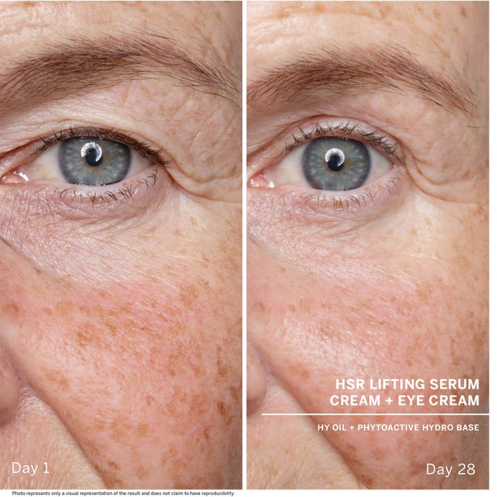 HSR Lifting Serum